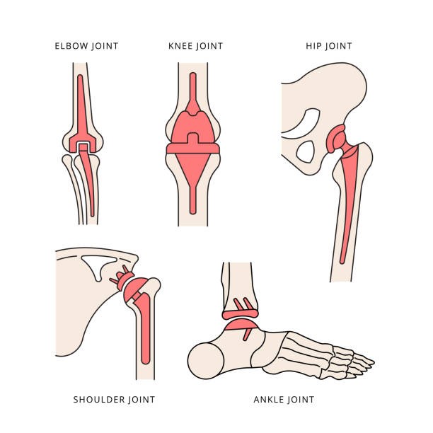 diagram of joints