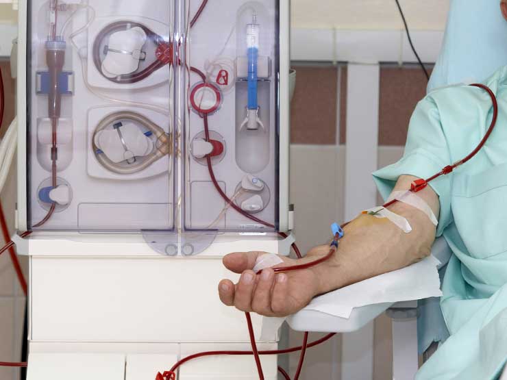 image of dialysis machine and patient using it