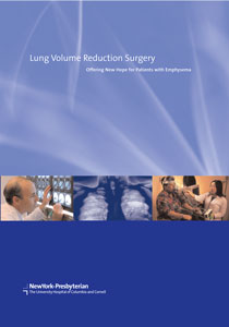 Lung Volume Reduction Surgery: Get Evaluated | NewYork-Presbyterian