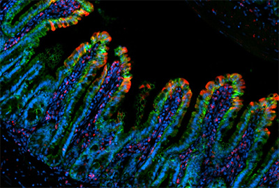 image of TNF-driven intestinal inflammation