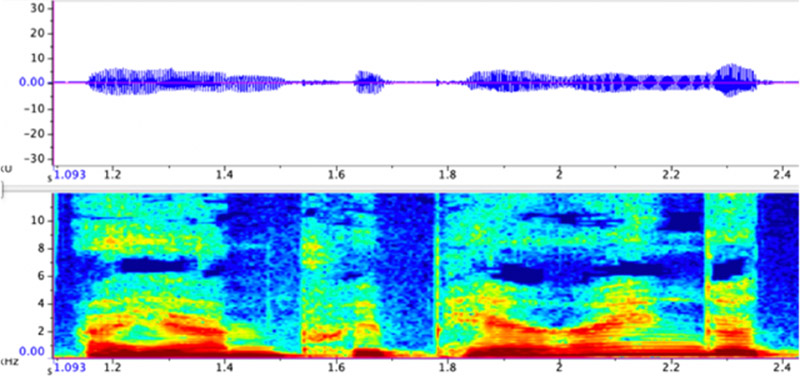 voice waveform and spectrogram
