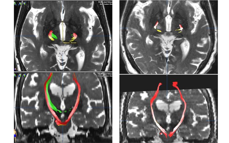 Axial and coronal images from before and after treatment