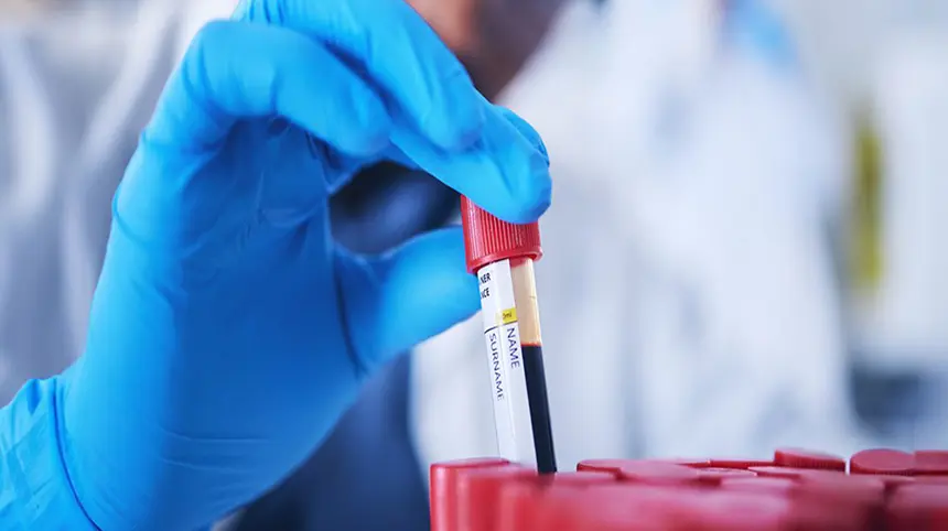 FDA Approves First Blood Test to Detect Colorectal Cancer