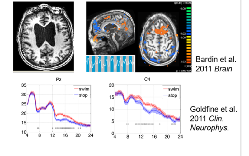 fMRI and EEG based analyses